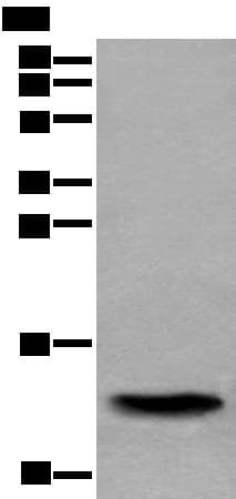 Polyclonal Rabbit anti-Human SAA4 Antibody (IHC, WB)