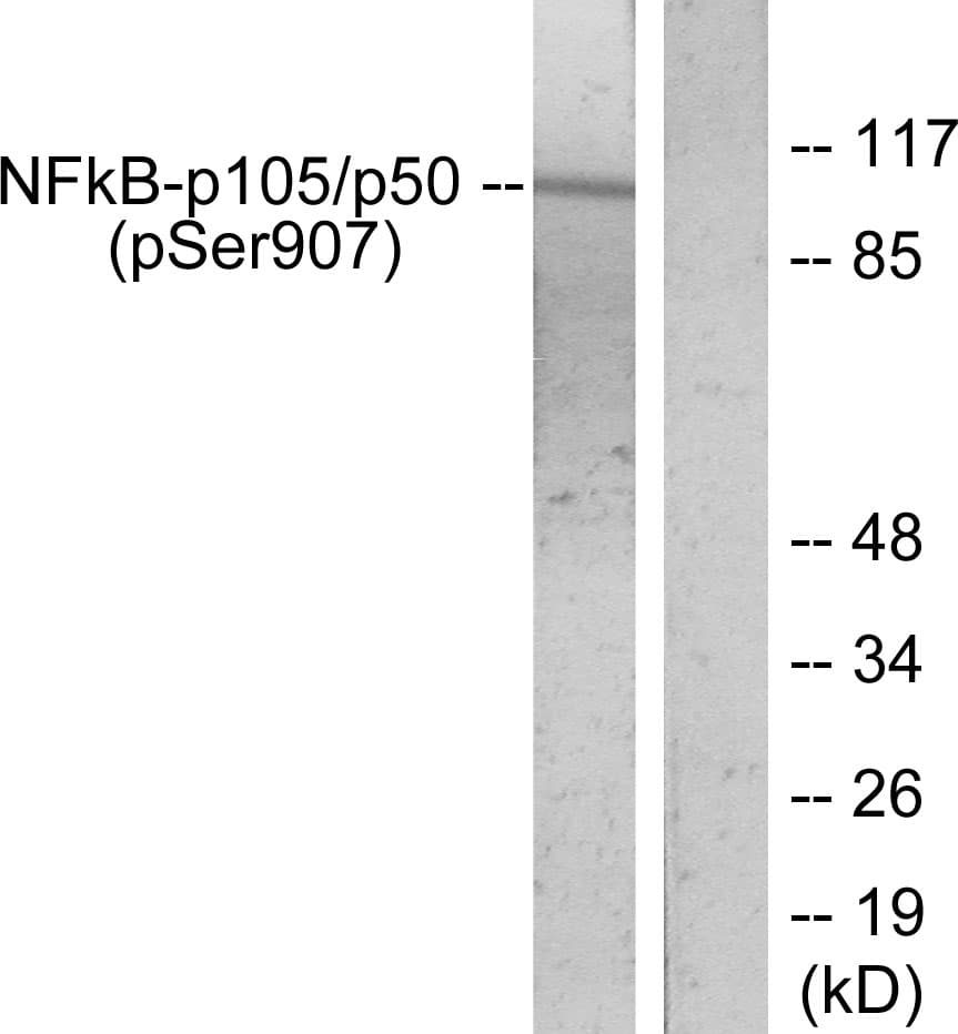 NFKB1 / NF-Kappa-B Antibody (phospho-Ser907)