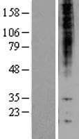 PSMB1 Protein (Over-Expression Lysate Myc-DDK (Flag))