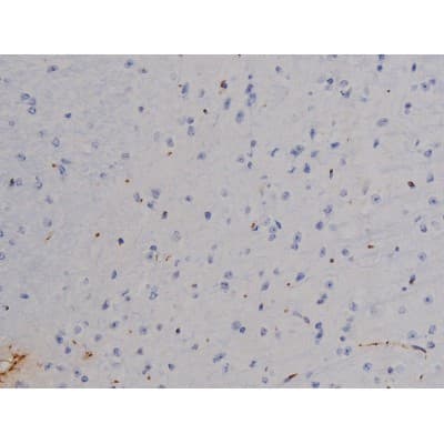 STAT6 Antibody (phospho-Thr645)