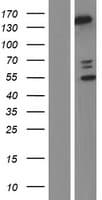 PLCB2 Protein (Over-Expression Lysate Myc-DDK (Flag))