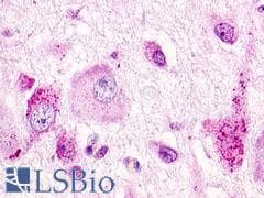 PathPlus™ Polyclonal Rabbit anti-Human GPR22 Antibody (Cytoplasmic Domain, IHC)