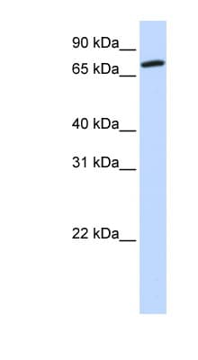 Polyclonal Rabbit anti-Human COG4 Antibody (aa576-625, WB)