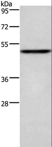 Polyclonal Rabbit anti-Human CKMT2 Antibody (IHC, WB)