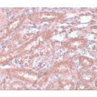 Polyclonal Chicken anti-Human ENC1 Antibody (IHC, IF, WB)