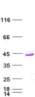 Human TS / Thymidylate Synthase Protein (Recombinant His, N-Terminal)