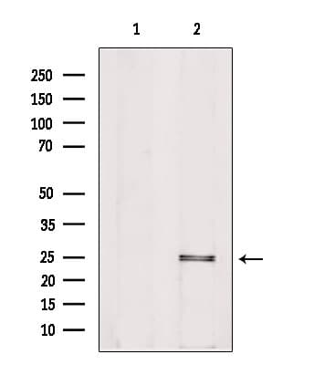 PIGF Antibody