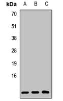 Polyclonal Rabbit anti-Human GNG2 Antibody (WB)
