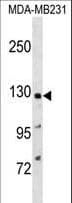 PPFIA1 / LIPRIN Antibody (aa52-80)