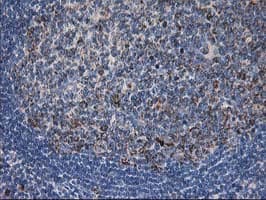 Monoclonal Mouse anti-Human DLD / Diaphorase / E3 Antibody (clone OTI4A10, IHC, IF, WB)
