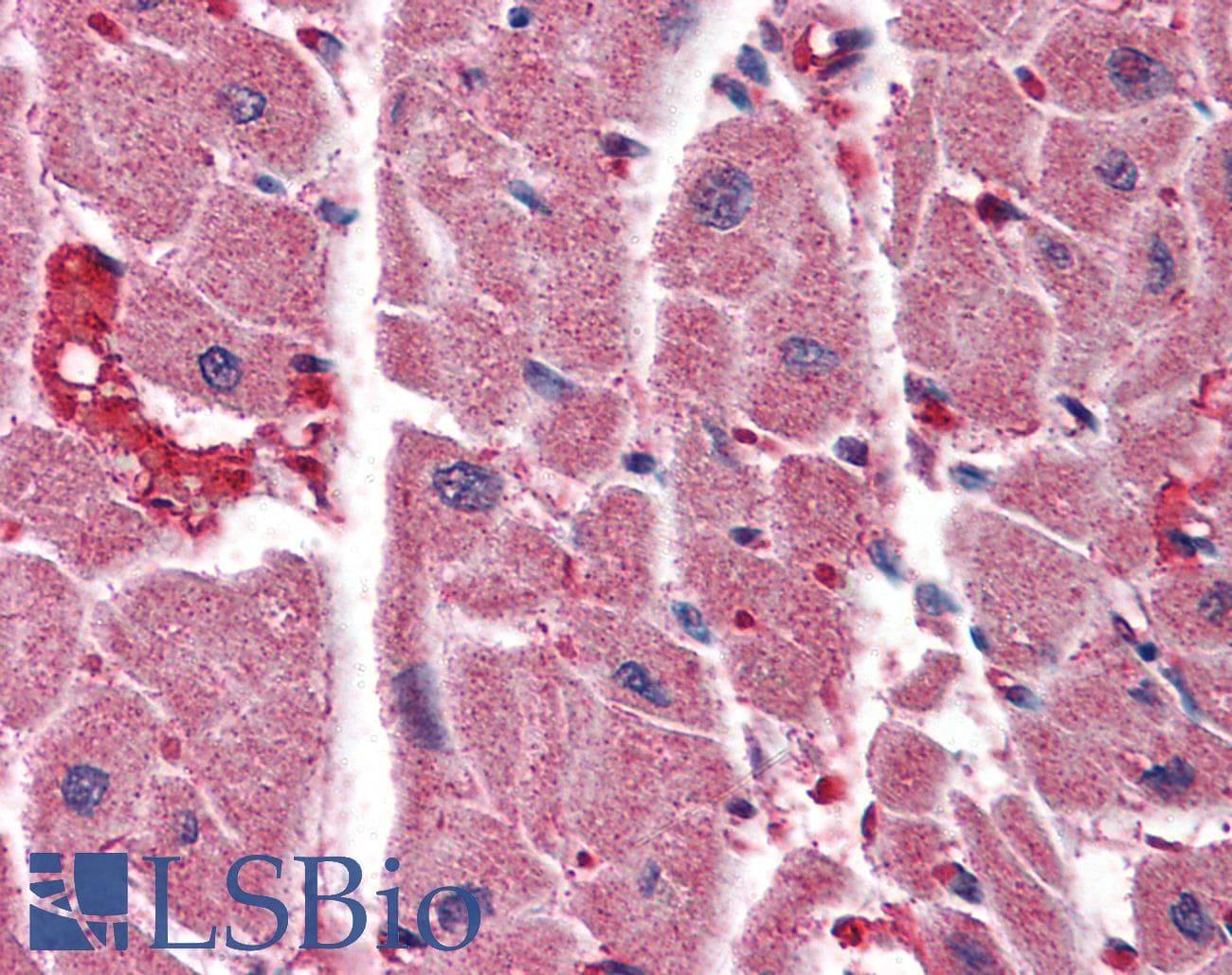 IHC-plus™ ITPR2 / IP3 Receptor Type 2 Antibody (aa1152-1164)