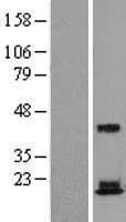 RPS18 / Ribosomal Protein S18 (Over-Expression Lysate Myc-DDK (Flag))