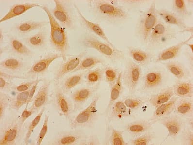 HIST1H3A Antibody