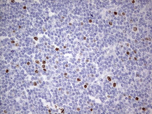 MKI67 / Ki67 Antibody (aa1160-1493, clone OTI8G3)