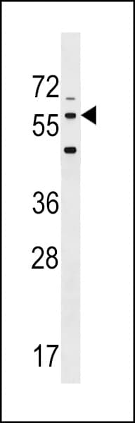 LRRTM2 Antibody (aa465-491)