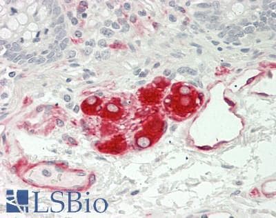 IHC-plus™ DMN / Desmuslin / Synemin Antibody (aa329-580, clone 2F4)