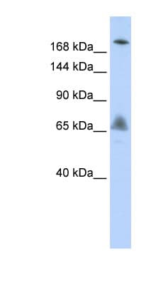 Polyclonal Rabbit anti-Human VPS8 Antibody (aa216-265, WB)