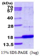Human DUSP23 Protein (Recombinant His)