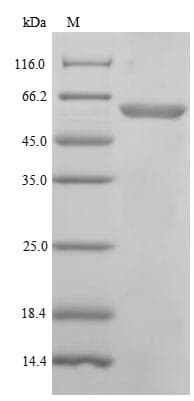 Human POLM / DNA Polymerase Mu Protein (Recombinant 6His, N-terminus)