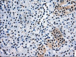 Monoclonal Mouse anti-Human PSMD10 / Gankyrin Antibody (clone OTI3F6, WB)