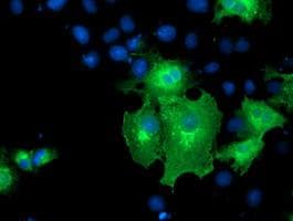 ERBB2 / HER2 Antibody (aa676-1255, clone OTI3F11, Carrier-free)
