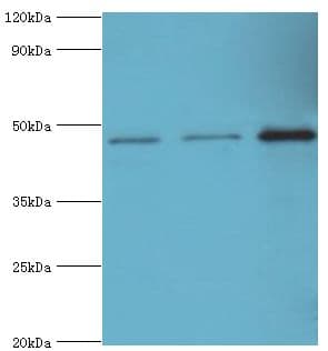 Polyclonal Rabbit anti-Human PIP4K2B Antibody (aa1-270, IHC, WB)