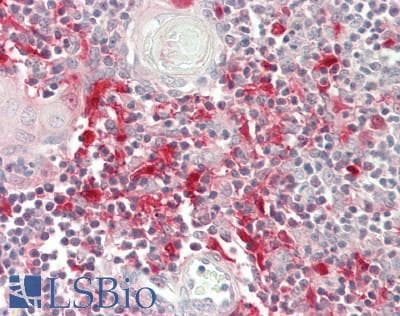 IHC-plus™ SUSD3 Antibody