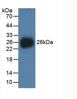 Human NEU1 / NEU Protein (Recombinant His, N-Terminal)