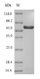 Aspergillus niger 3-Phytase A Protein (Recombinant 6His, N-terminus)