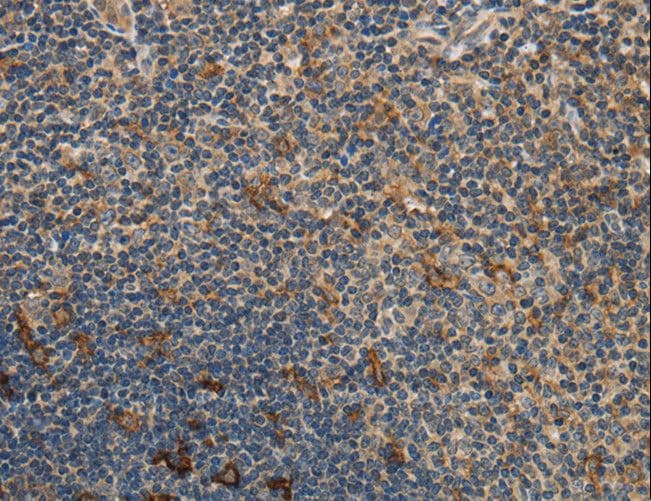 GGT1 / GGT Antibody (aa1-225)