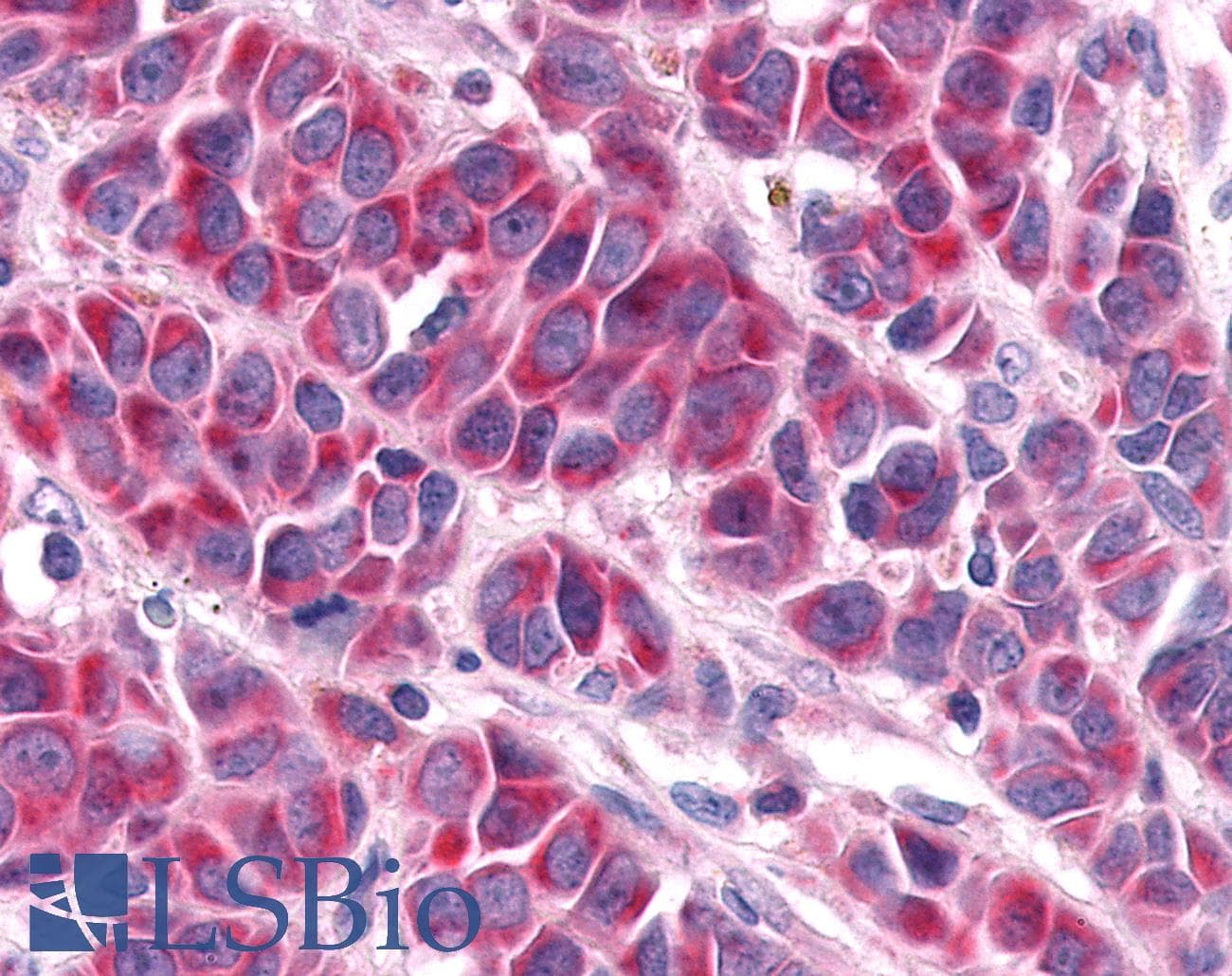 PathPlus™ Polyclonal Rabbit anti-Human RORA / ROR Alpha Antibody (Ligand-binding Domain, IHC)