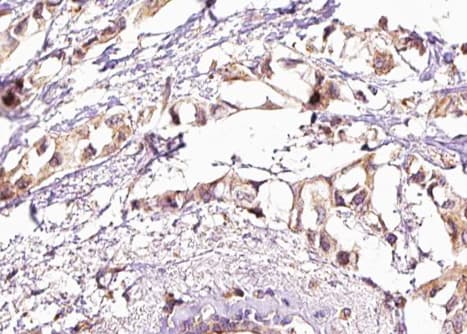 Polyclonal Rabbit anti-Human HSF1 Antibody (phospho-Ser303, IHC, IF, WB)