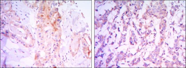 Monoclonal Mouse anti-Human RICTOR Antibody (clone 7B3, IHC, IF, WB)
