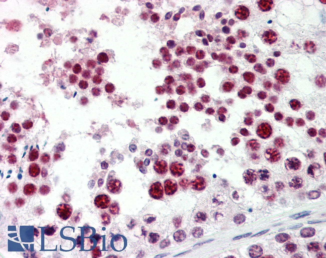 IHC-plus™ EZH2 Antibody (Internal)