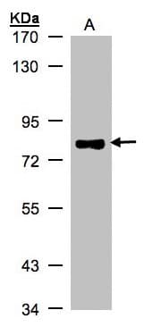 TP63 / p63 Antibody (aa125-415)