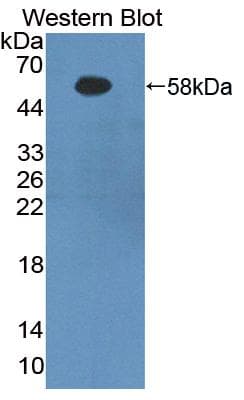 FGB / Fibrinogen Beta Chain Antibody (aa55-118)