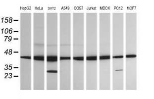 MAP2K1 / MKK1 / MEK1 Antibody (clone OTI1F9)