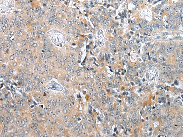 COMMD6 Antibody