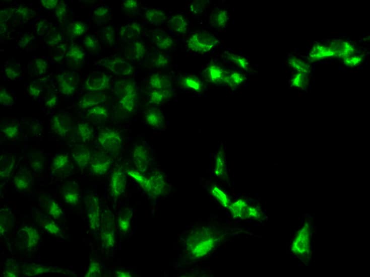 Polyclonal Rabbit anti-Human FCGR1A / CD64 Antibody (IHC, IF, WB)