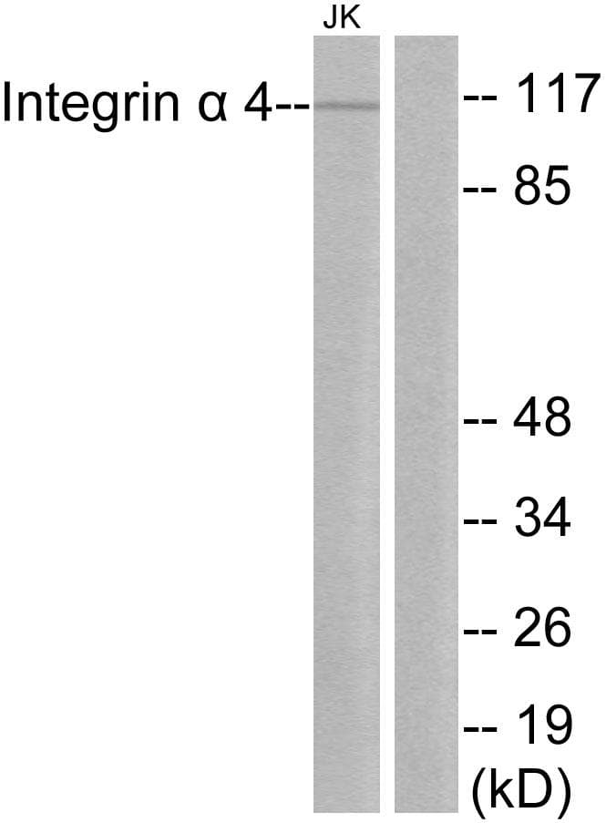 ITGA4 / VLA-4 / CD49d Antibody (p1027)