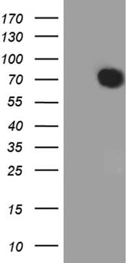 PEA3 / ETV4 Antibody (aa1-276, clone OTI1E11)