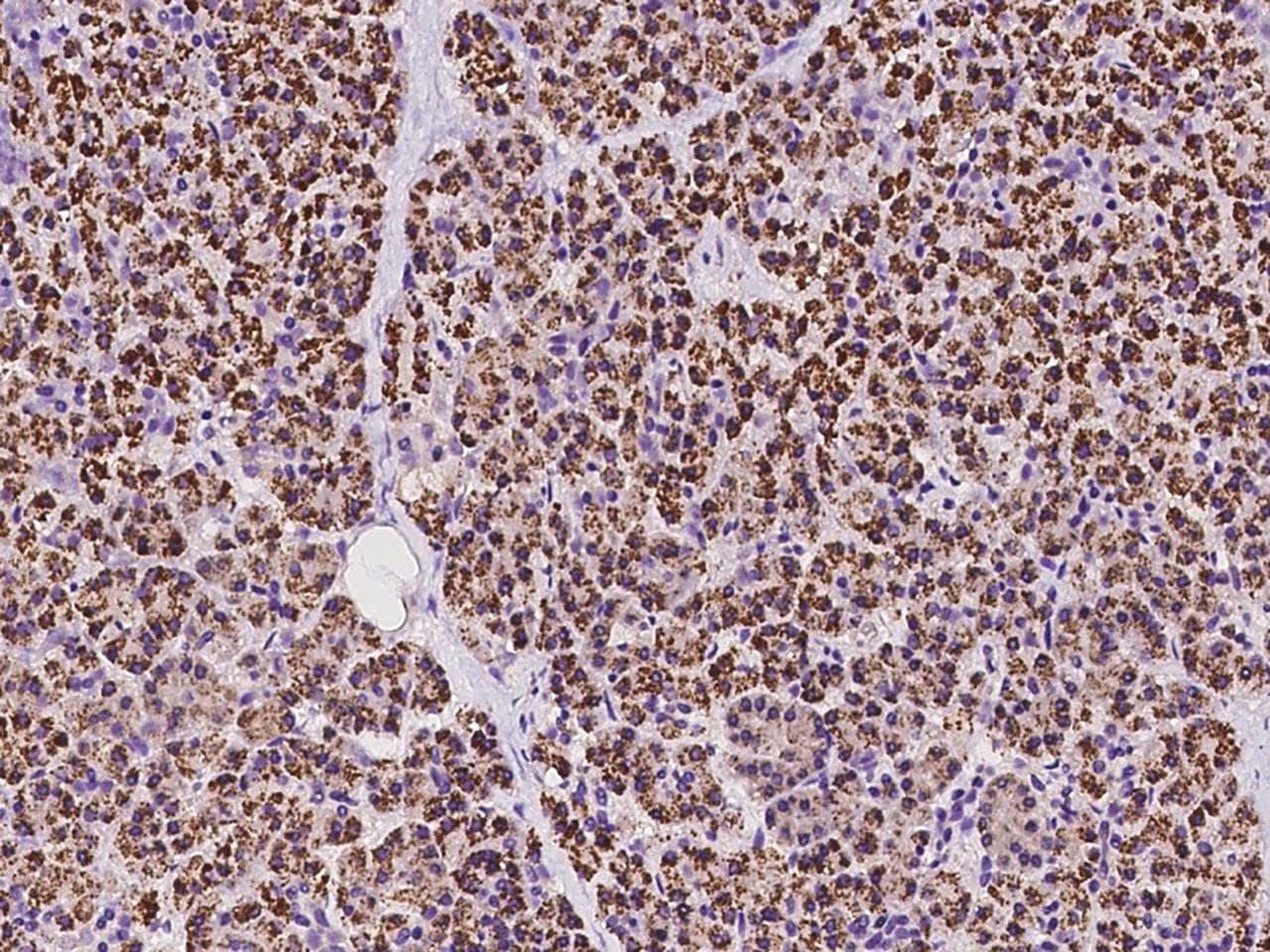 SCYL1 / NTKL Antibody