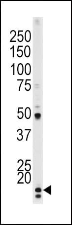 CDKN1A / WAF1 / p21 Antibody (phospho-Thr145)