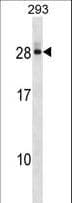 Polyclonal Rabbit anti-Human DCTD / dCMP Deaminase Antibody (aa1-30, WB)
