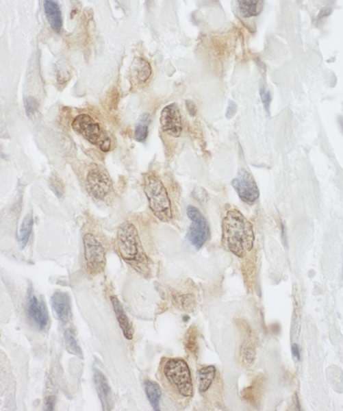 LIM Protein / LPP Antibody (aa75-125)