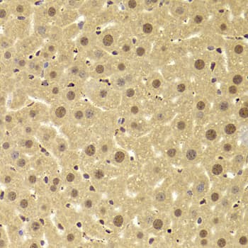 PHAP1 / ANP32A Antibody