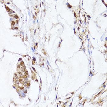 Polyclonal Rabbit anti-Human EGLN1 + EGLN2 Antibody (IHC)