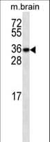 Monoclonal Mouse anti-Mouse MLST8 / GBL Antibody (WB)