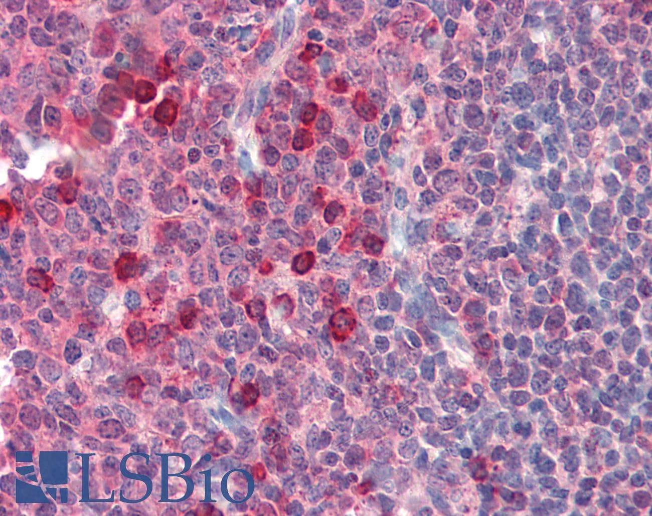 IHC-plus™ EXOC3 / SEC6 Antibody (clone 9H5)