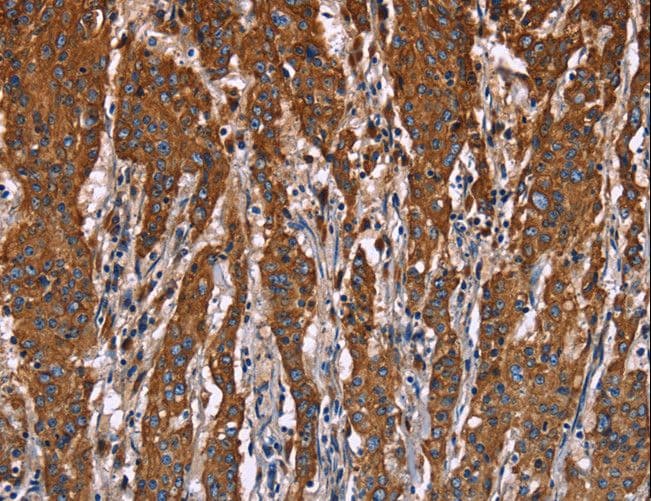 LAMP2 / CD107b Antibody